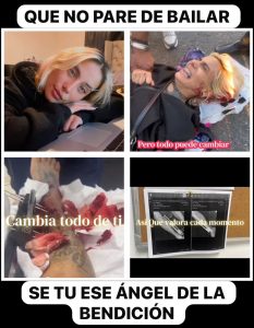 Llamado urgente a la solidaridad para salvar las piernas de joven bailarina dominicana